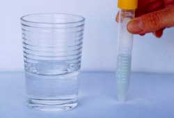Dithizone Test